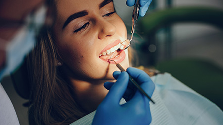 zobozdravstveni pregled